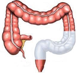 Appendisectomy_Laparoscopic_Jan_2019_001